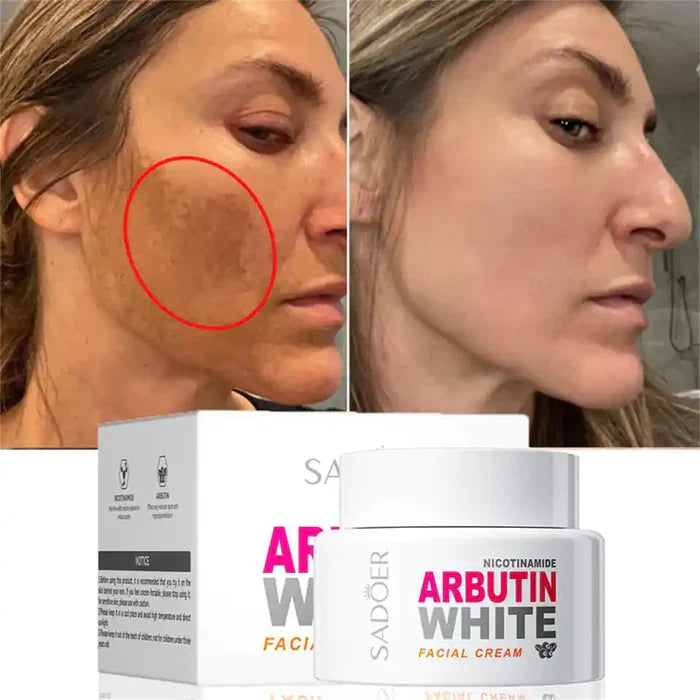 Arbutin White – Luminosidad Profesional para una Piel Radiante ✨